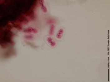 S002 100x.JPG